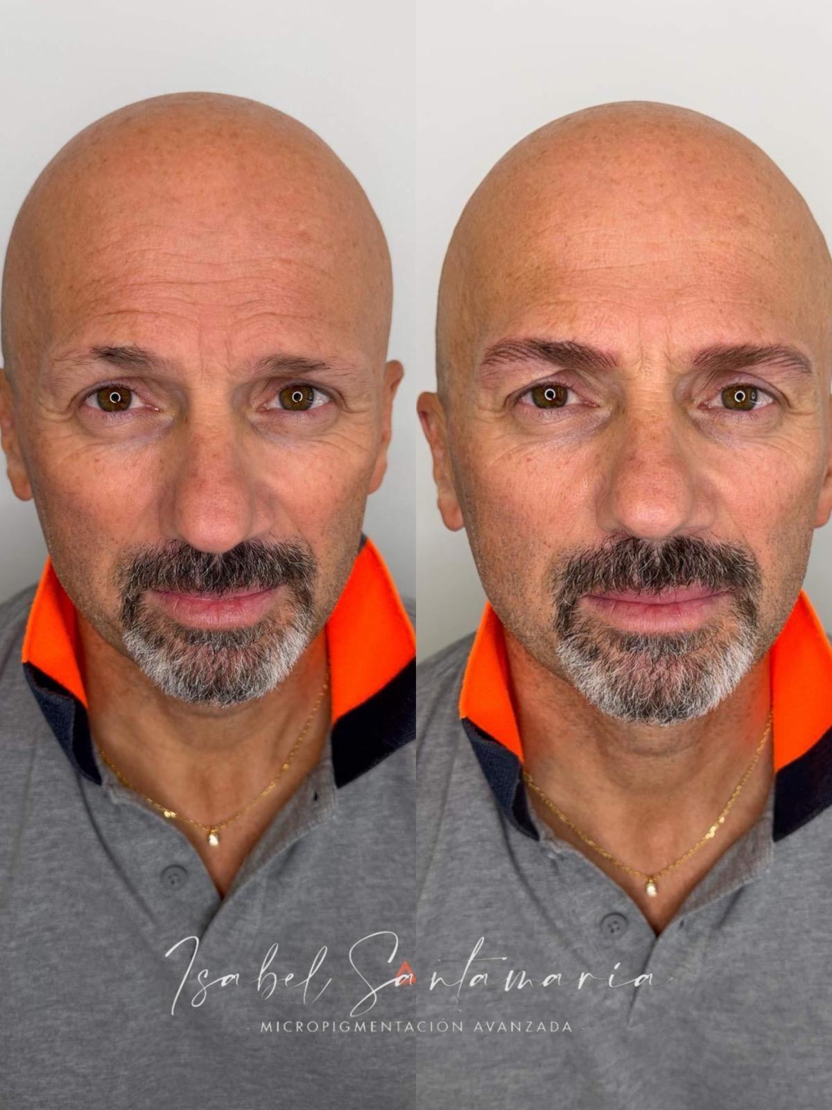 Micropigmentación de cejas para hombre — antes y después resultado natural